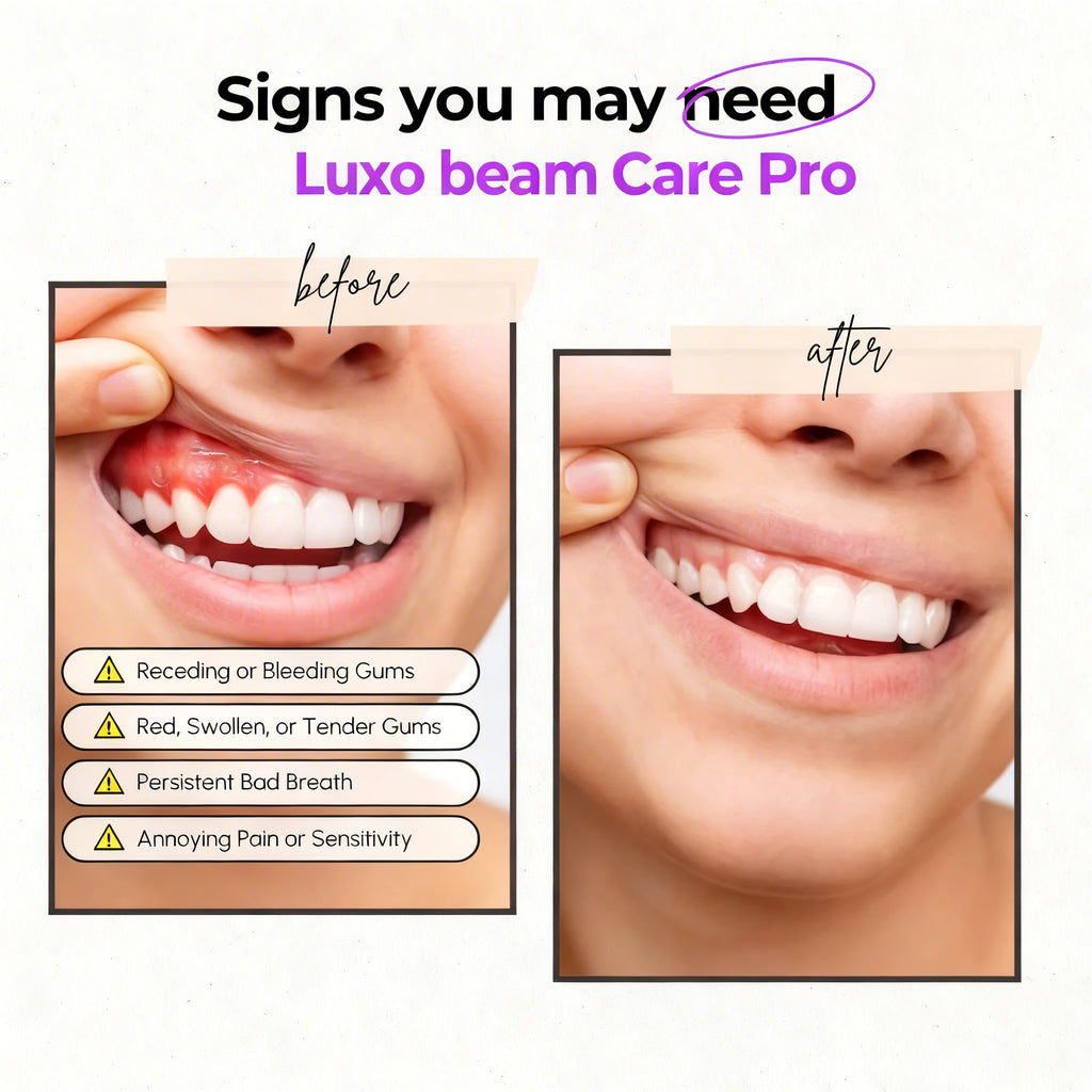 Luxobeam Oral Care Pro