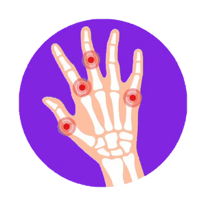 ARTHRITIS & JOINT PAIN