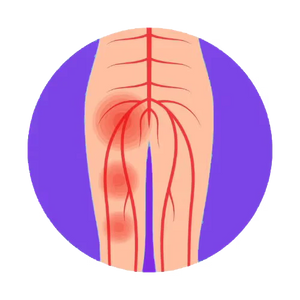 NERVE PAIN & NEUROPATHY